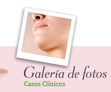 Casos Clínicos
